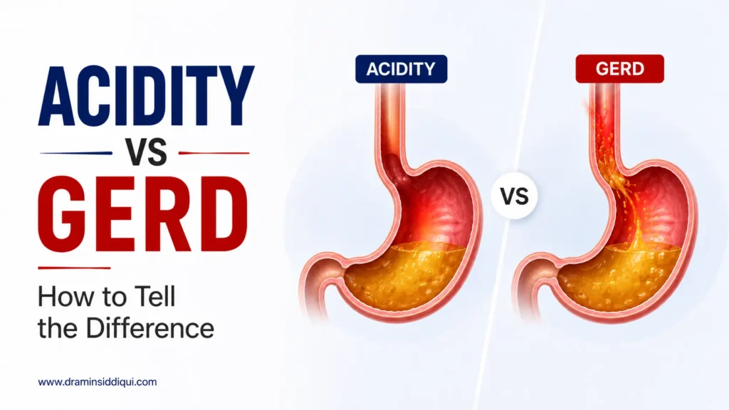 acidity vs GERD