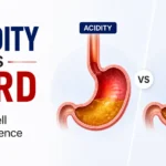 Acidity vs GERD – How to Tell the Difference