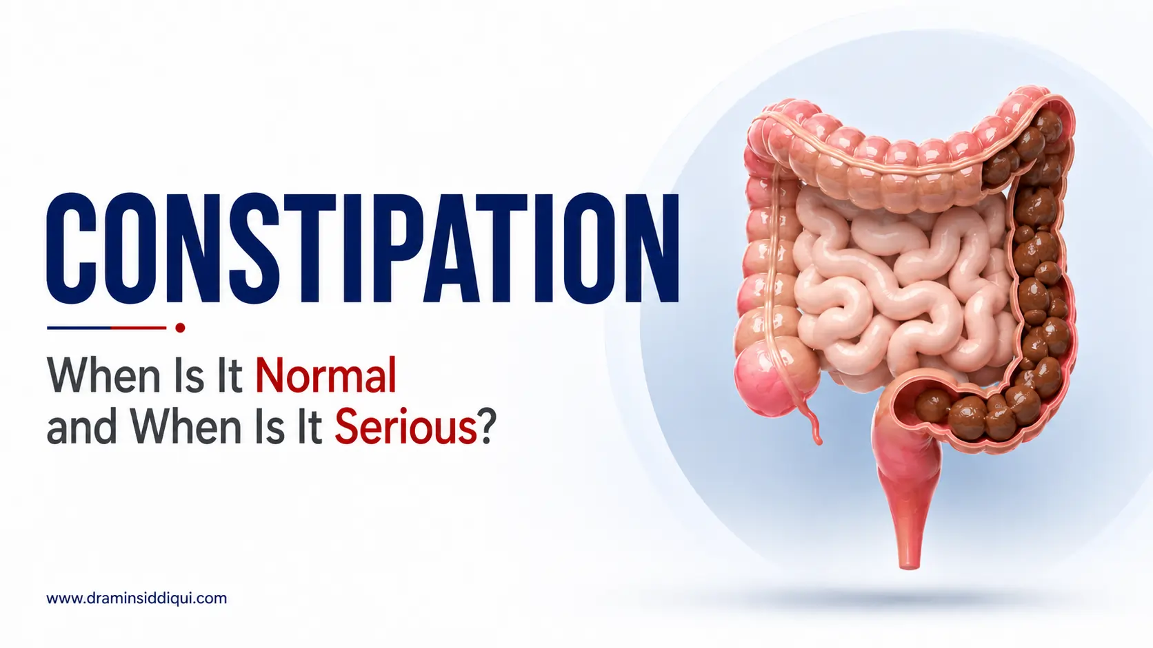 constipation